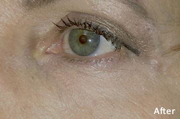 ACCUTITE & FACETITE after image