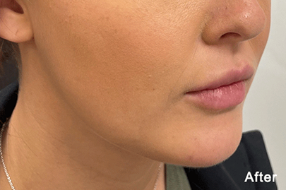 QUANTUMRF 10 after image